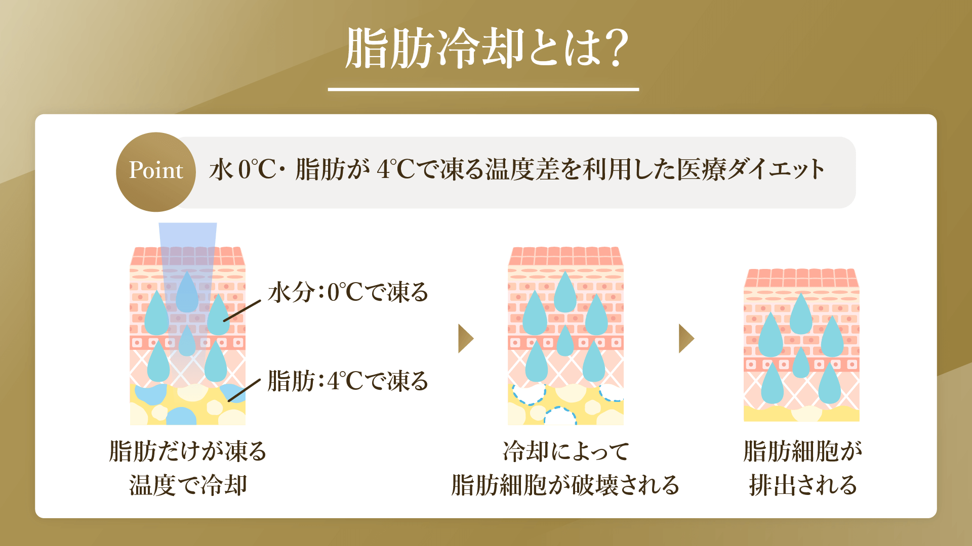 脂肪冷却が安いクリニックおすすめ9選｜相場や安く受ける方法も解説